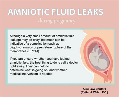 how to tell if your leaking amniotic fluid|Leaking amniotic fluid (premature rupture of membranes)